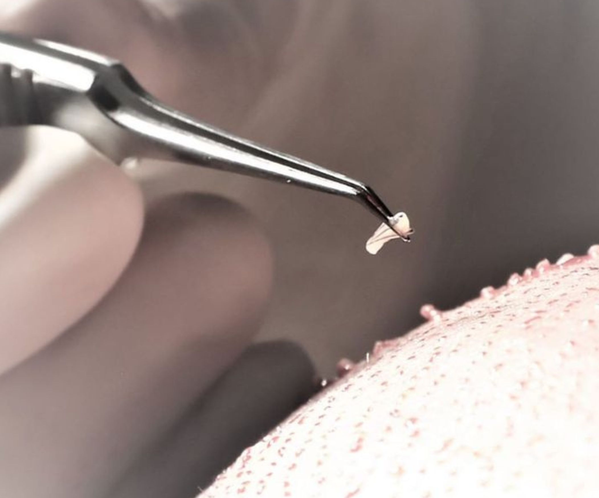Graft Extraction procedure